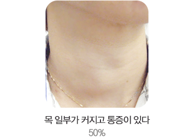 �� �Ϻΰ� Ŀ���� ������ �ִ�. 50%