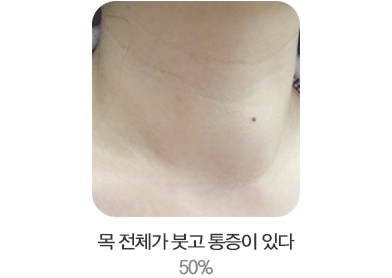 �� ��ü�� �װ� ������ �ִ�. 50%