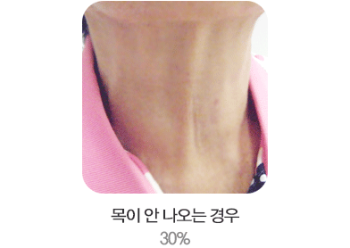 ¸ñÀÌ ¾È³ª¿À´Â °æ¿ì 30%