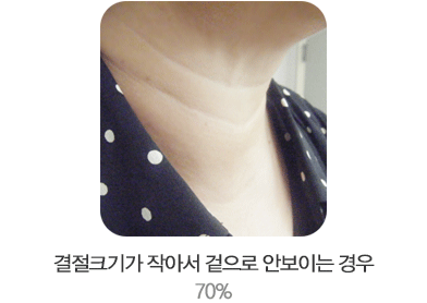 ���� ũ�Ⱑ �۾Ƽ� ������ �Ⱥ��̴� ��� 70%