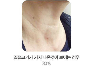 ����ũ�Ⱑ Ŀ�� ���°��� ���̴� ��� 30%